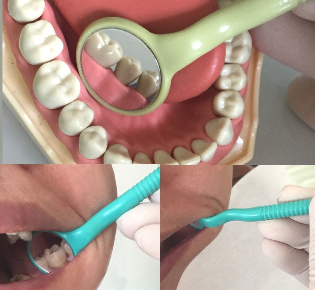 Buy dental autoclavable two sided mouth mirrors (per pc) , Dental