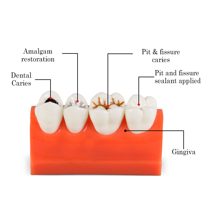 Product Image Product